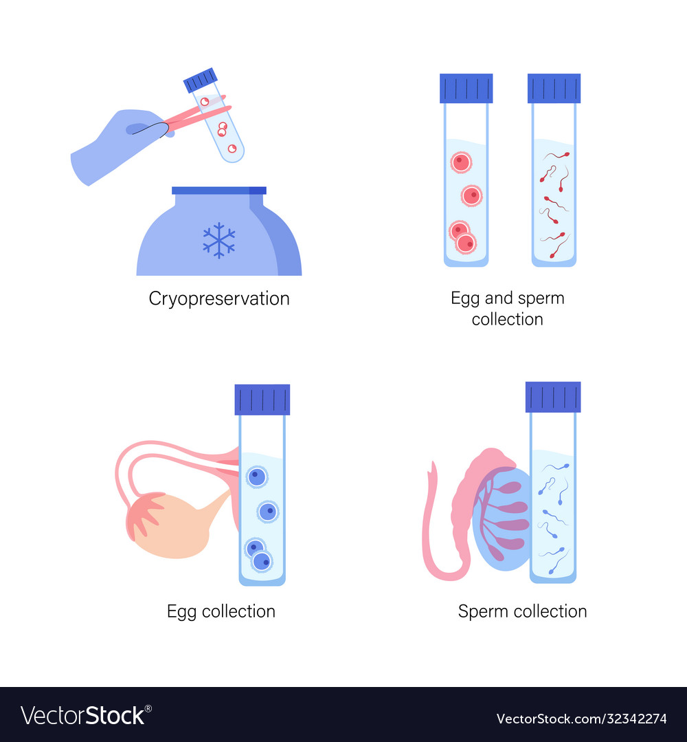 Ivf sperm donation