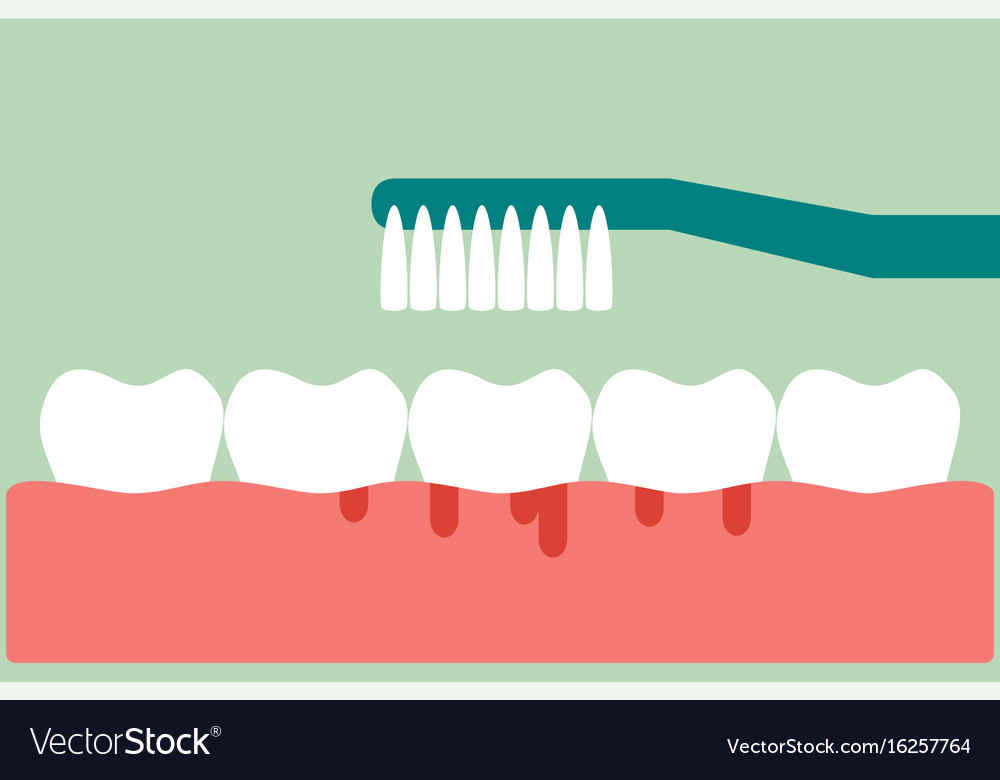 Brushing Teeth With Bleeding On Gum And Tooth Vector Image