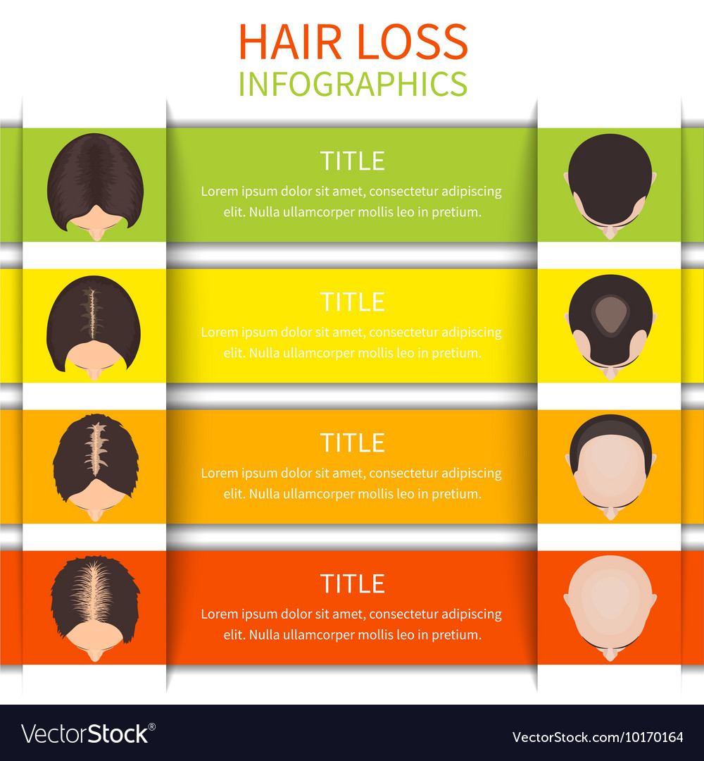 Hair Loss Infographic Template Royalty Free Vector Image