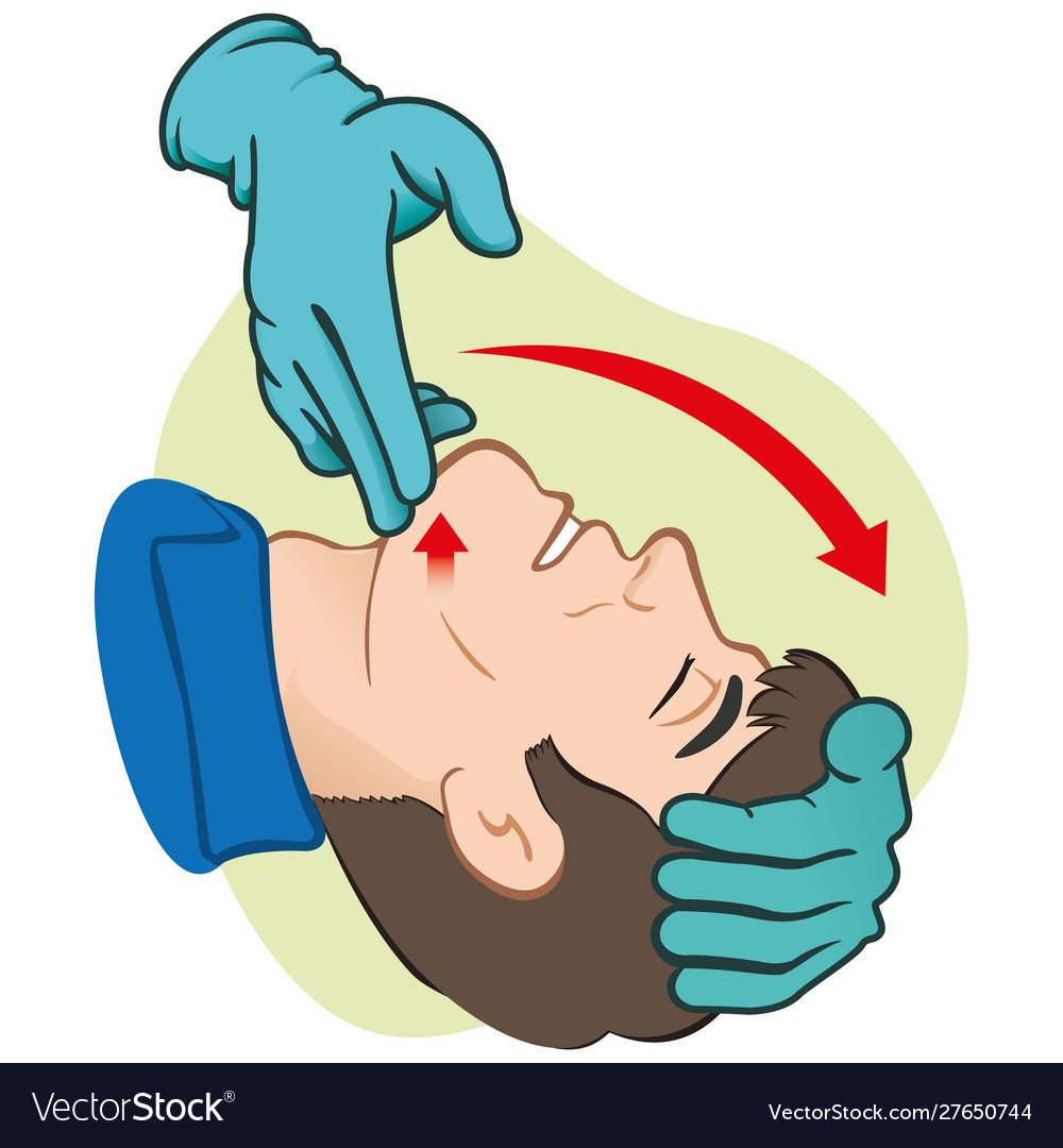 How To Open Airway