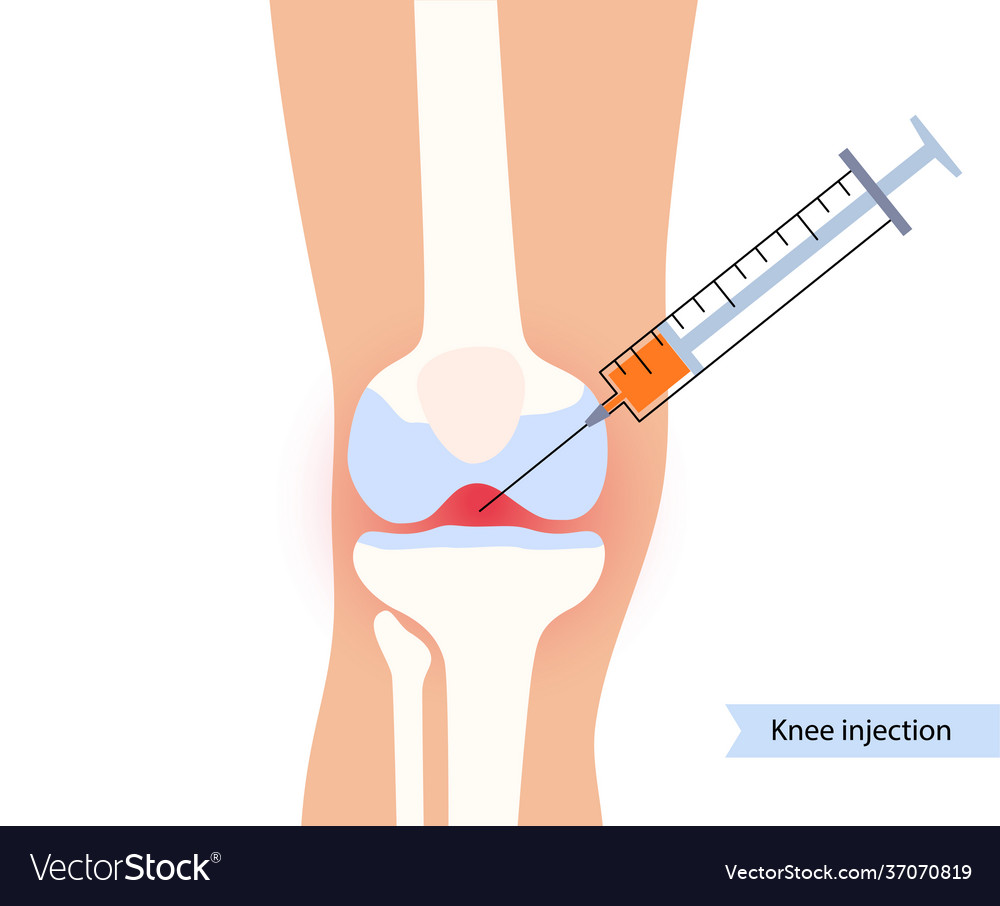 Knee injection concept