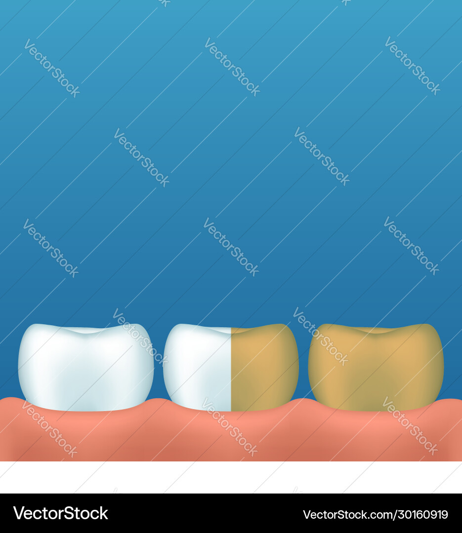 Teeth on blue Royalty Free Vector Image - VectorStock