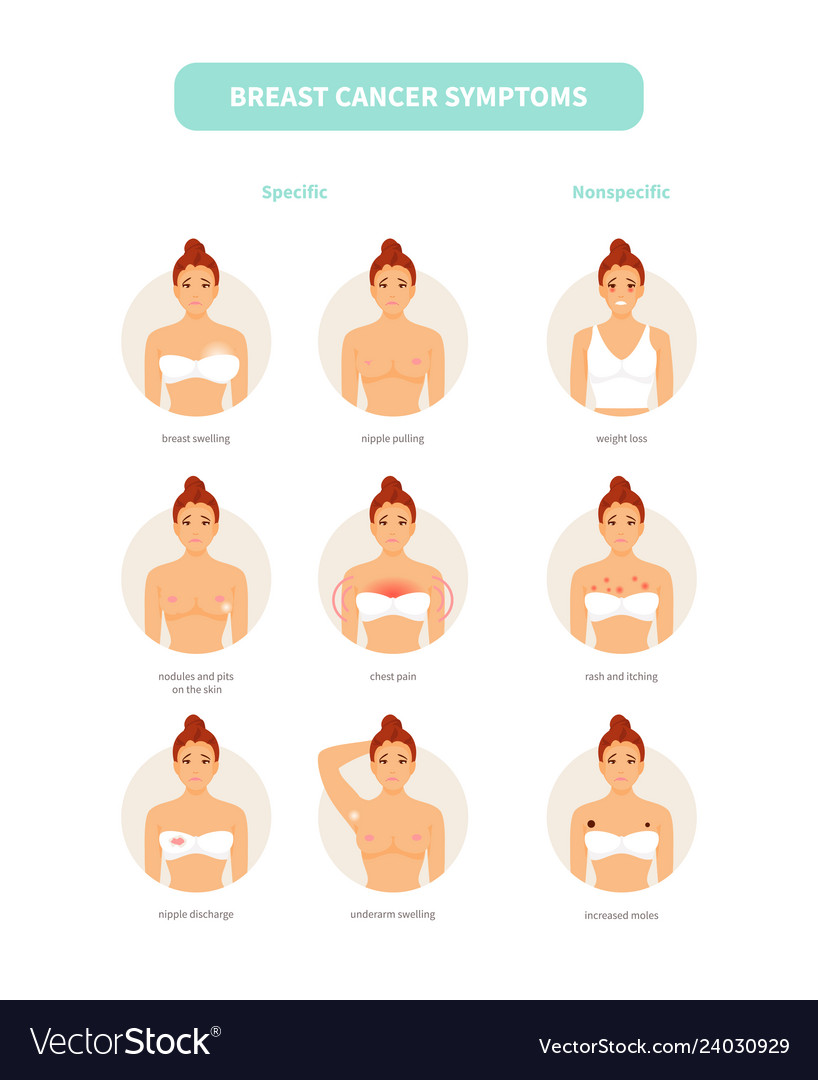 Symptoms breast cancer or nipple pain Royalty Free Vector