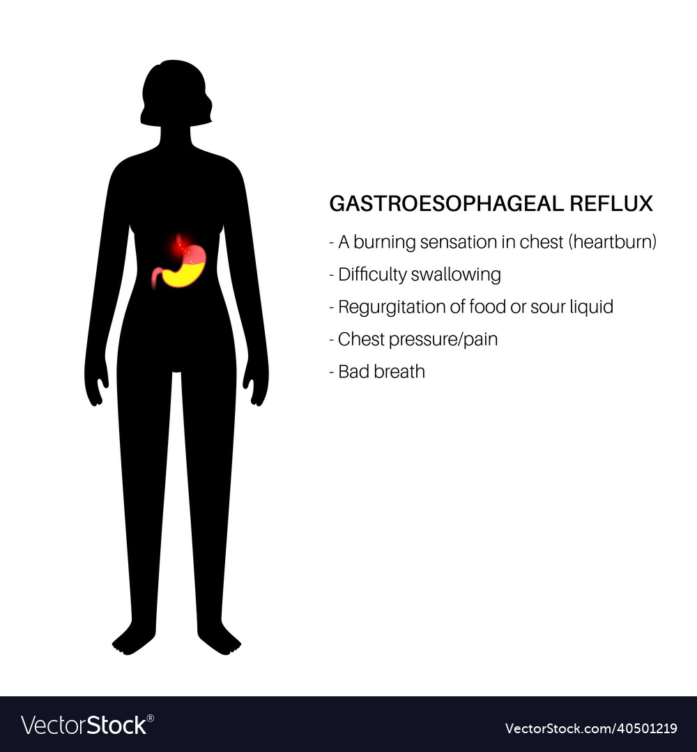 Gastroesophageal Reflux Disease Royalty Free Vector Image