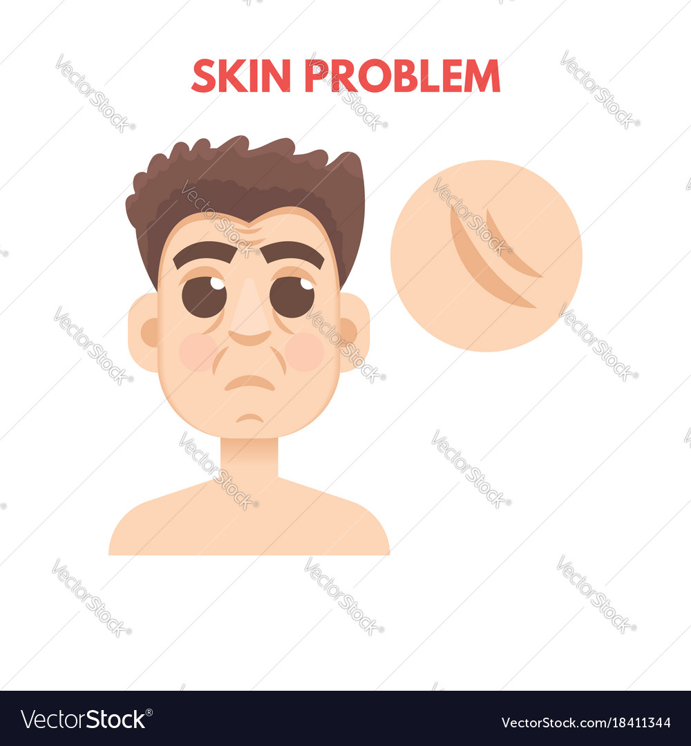 Men skin problem facial care