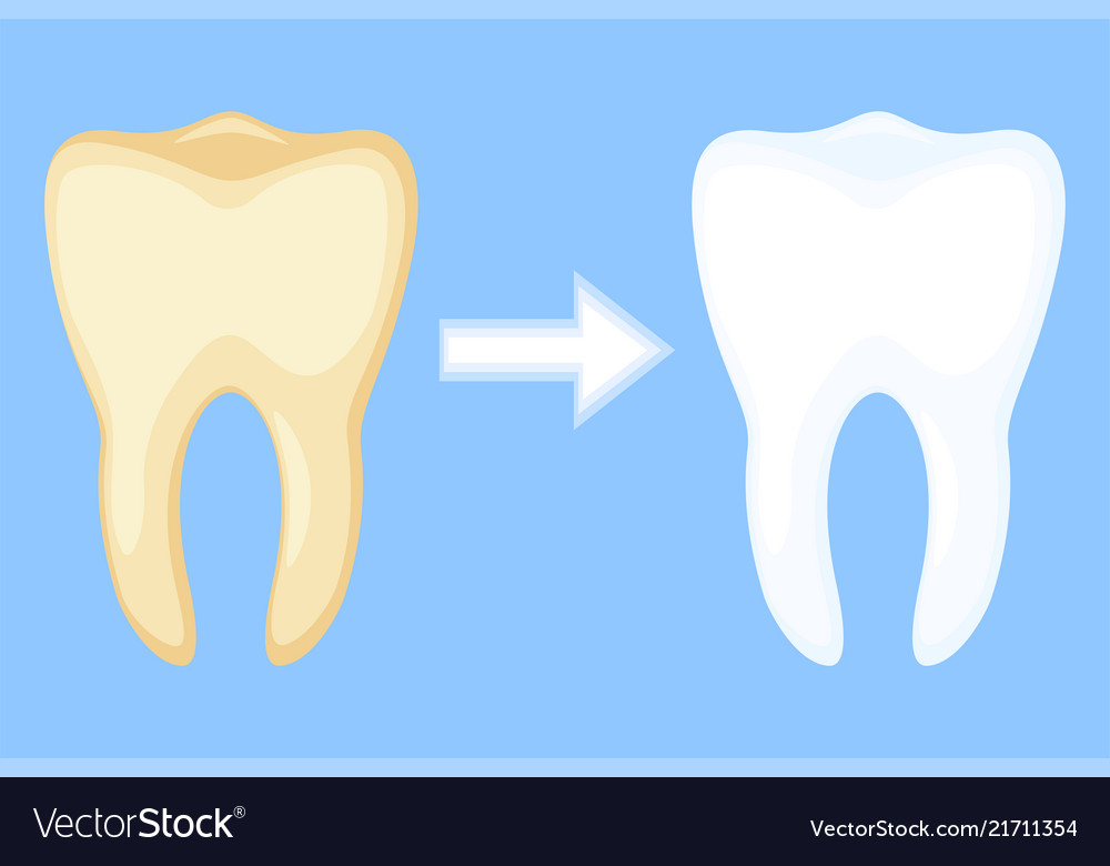 Teeth whitening concept before and after Vector Image