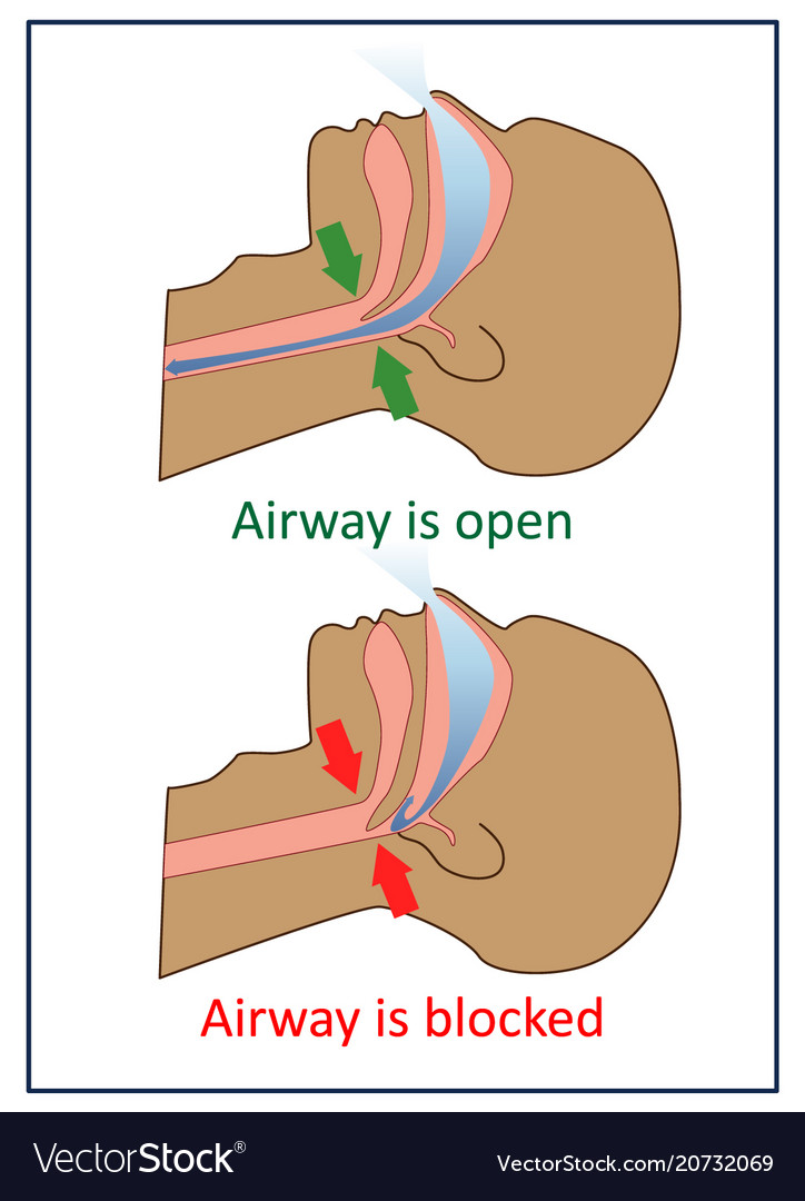 Snoring and sleep apnea about health care Vector Image