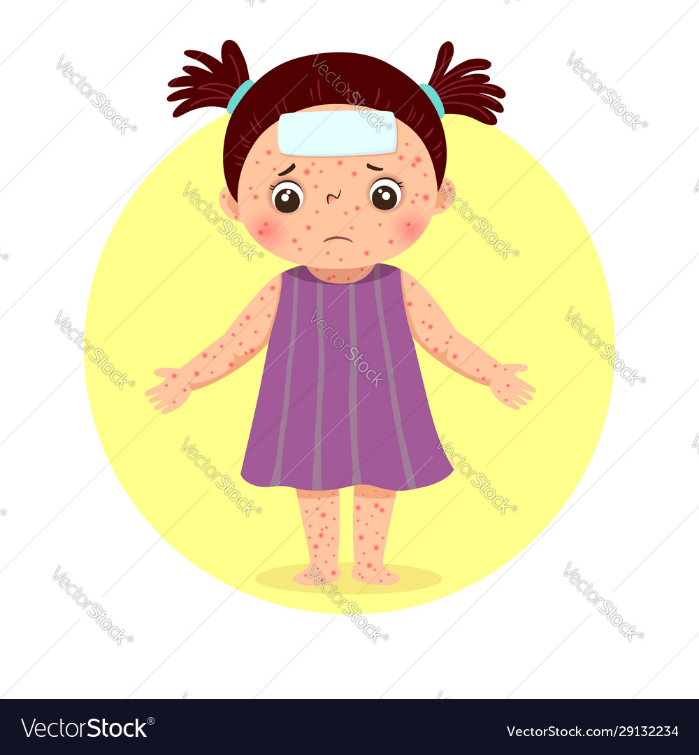 A little girl with rashes Royalty Free Vector Image