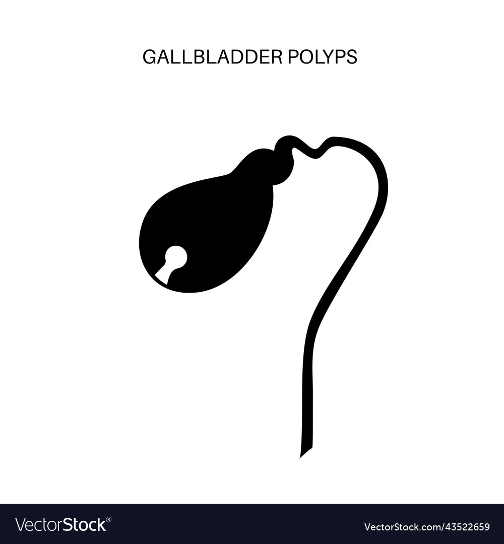 Gallbladder polyp anatomy Royalty Free Vector Image