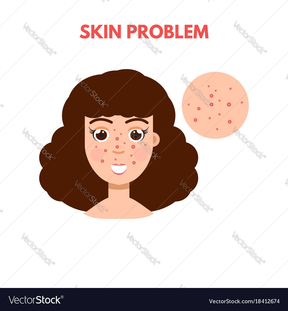 Woman with skin problem