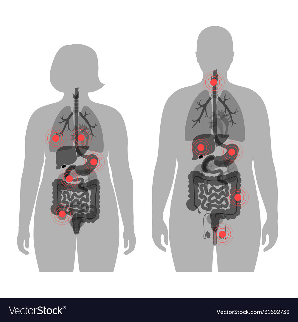 Pain in human body