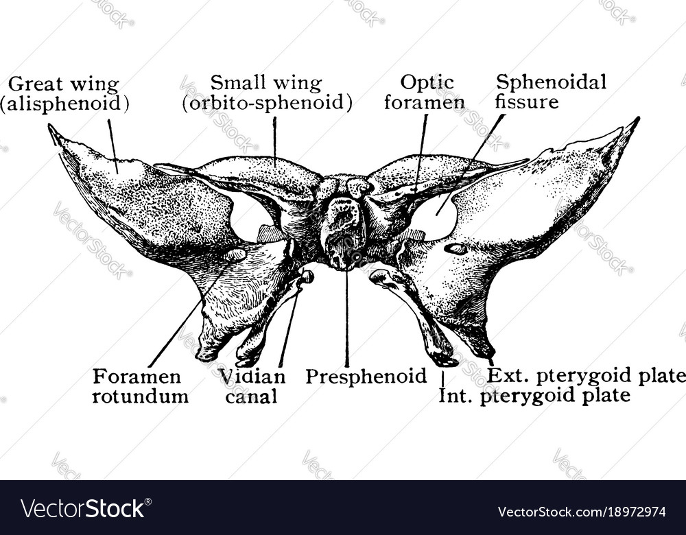 Sphenoid Knochen bei Geburt von vor dem Jahrgang