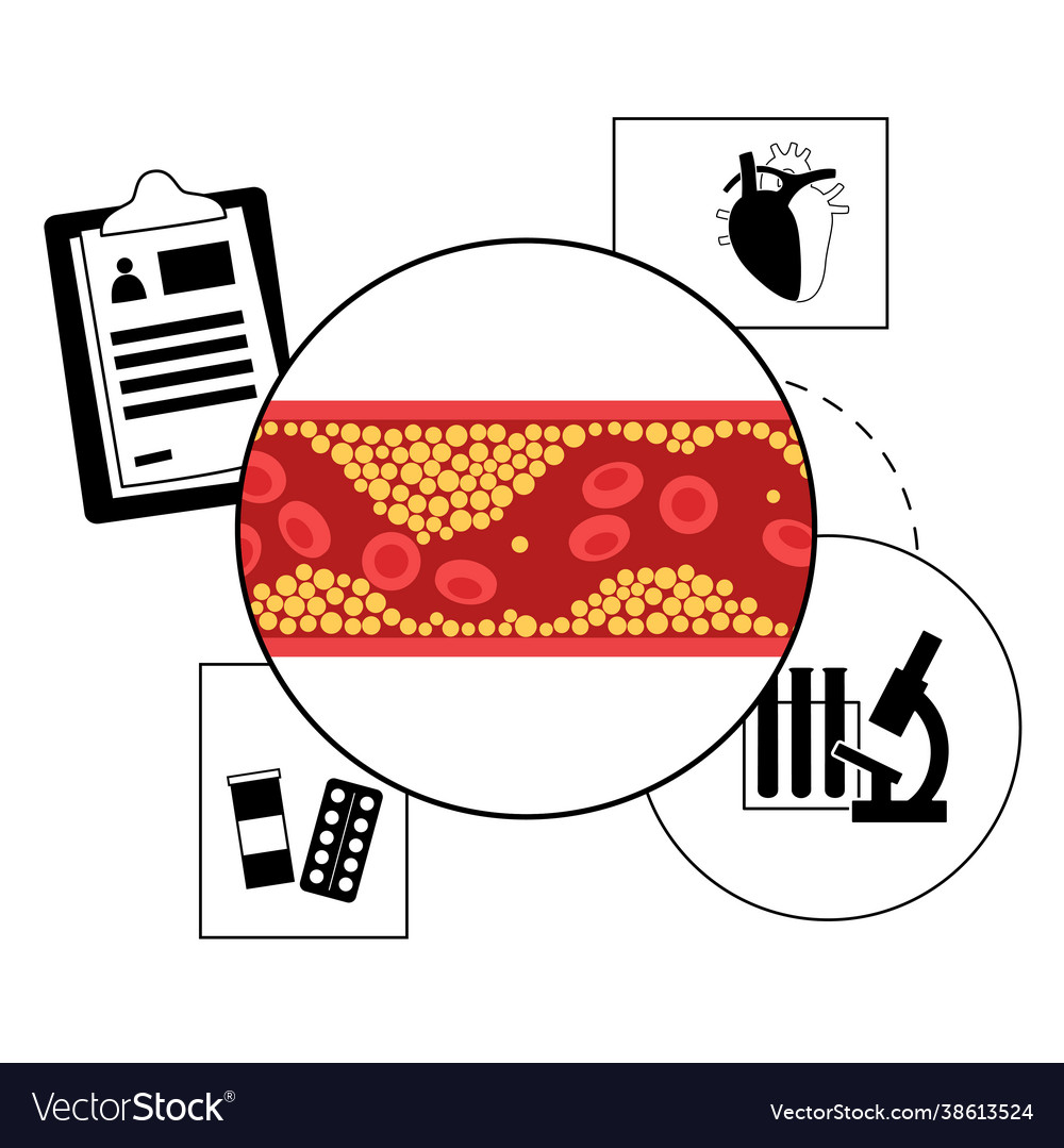 Cholesterol heart disease