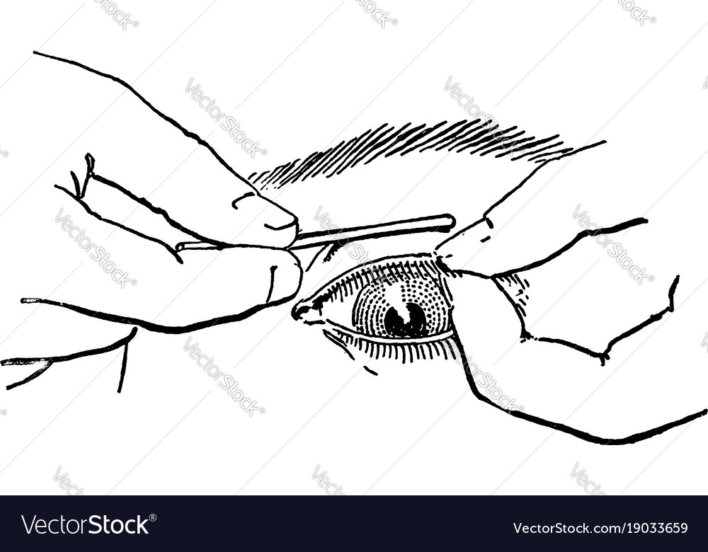 Everted eyelid vintage Royalty Free Vector Image