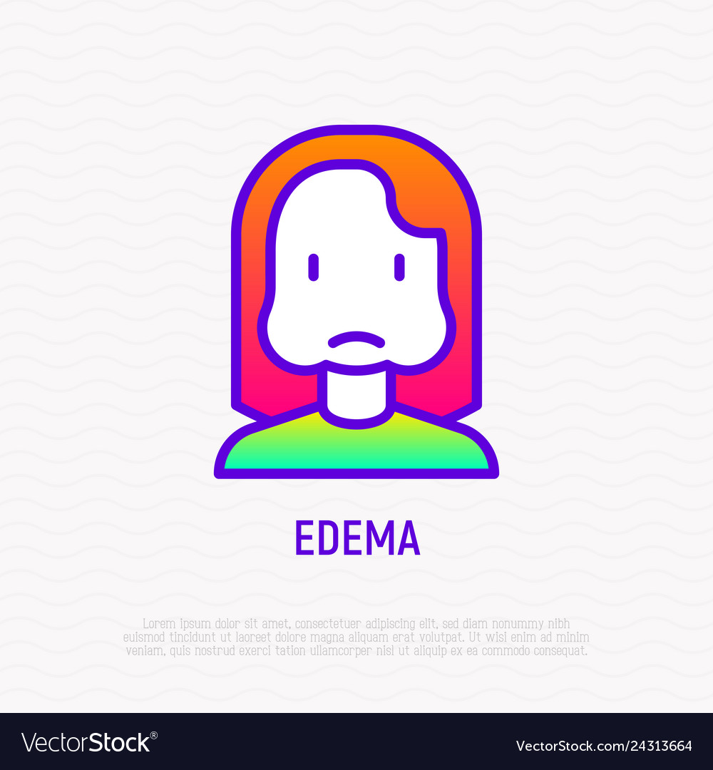 Edema thin line icon woman with swollen cheeks