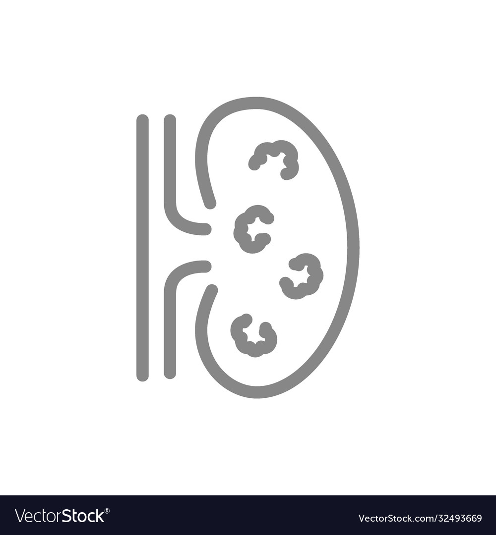 Kidney with tumors line icon renal cell carcinoma