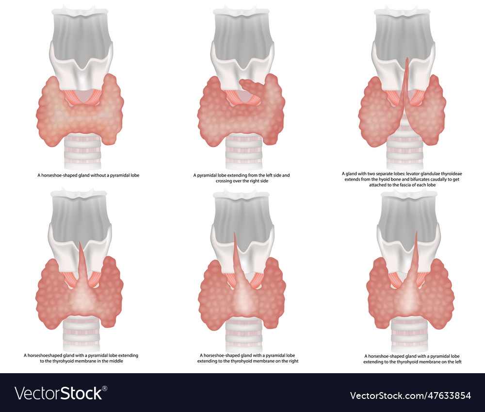 The Classification Of Thyroid Royalty Free Vector Image