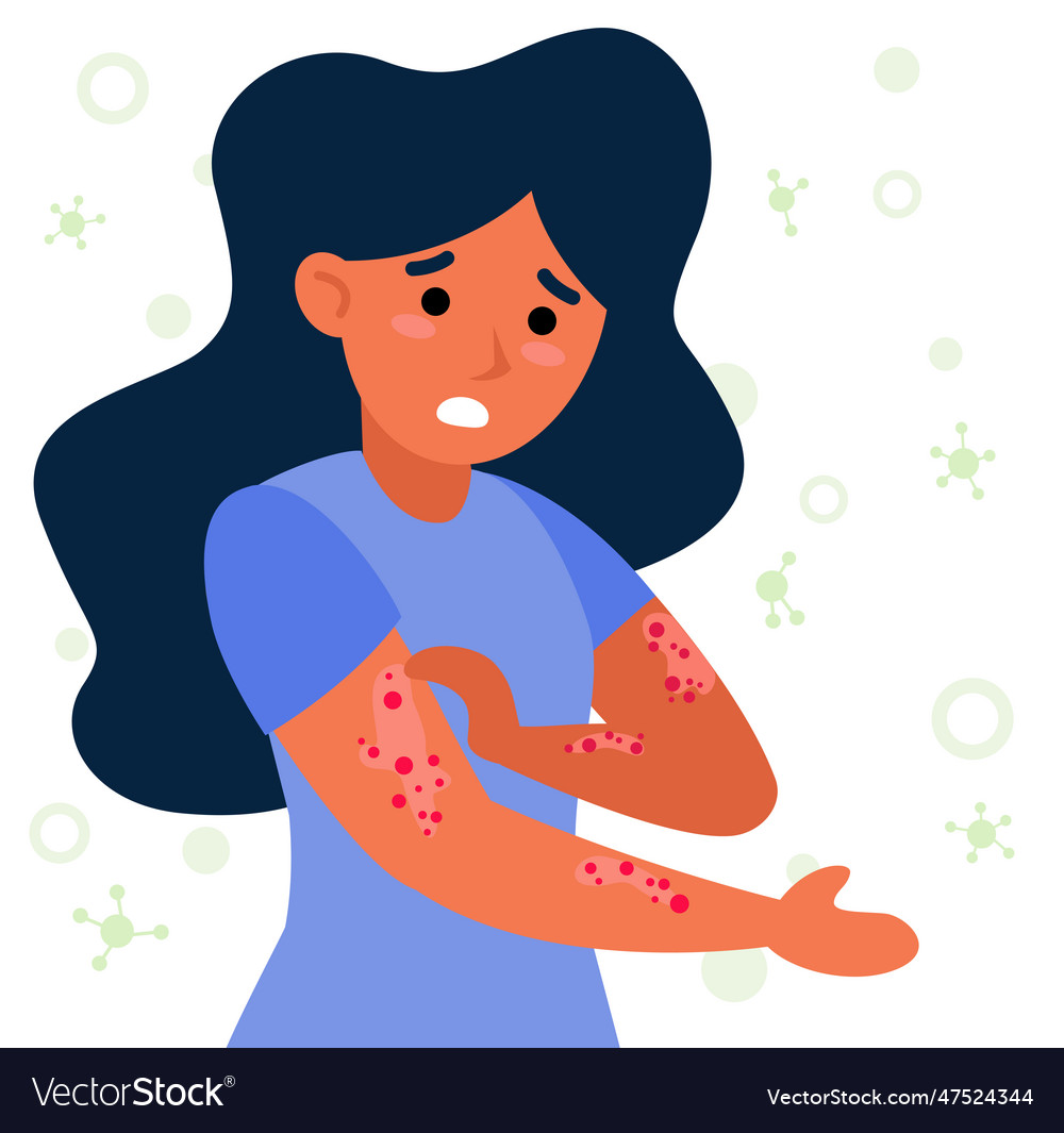 Woman with strong allergy symptoms flat Royalty Free Vector