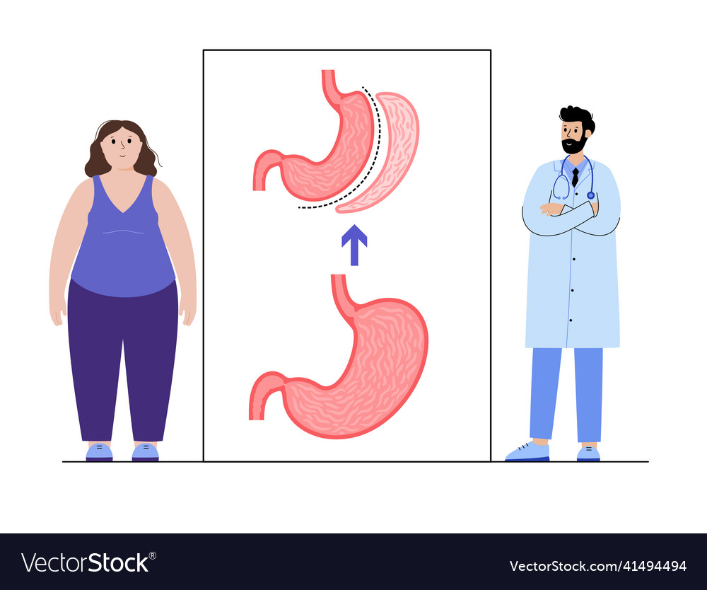 Laparoscopic Sleeve Gastrectomy Royalty Free Vector Image