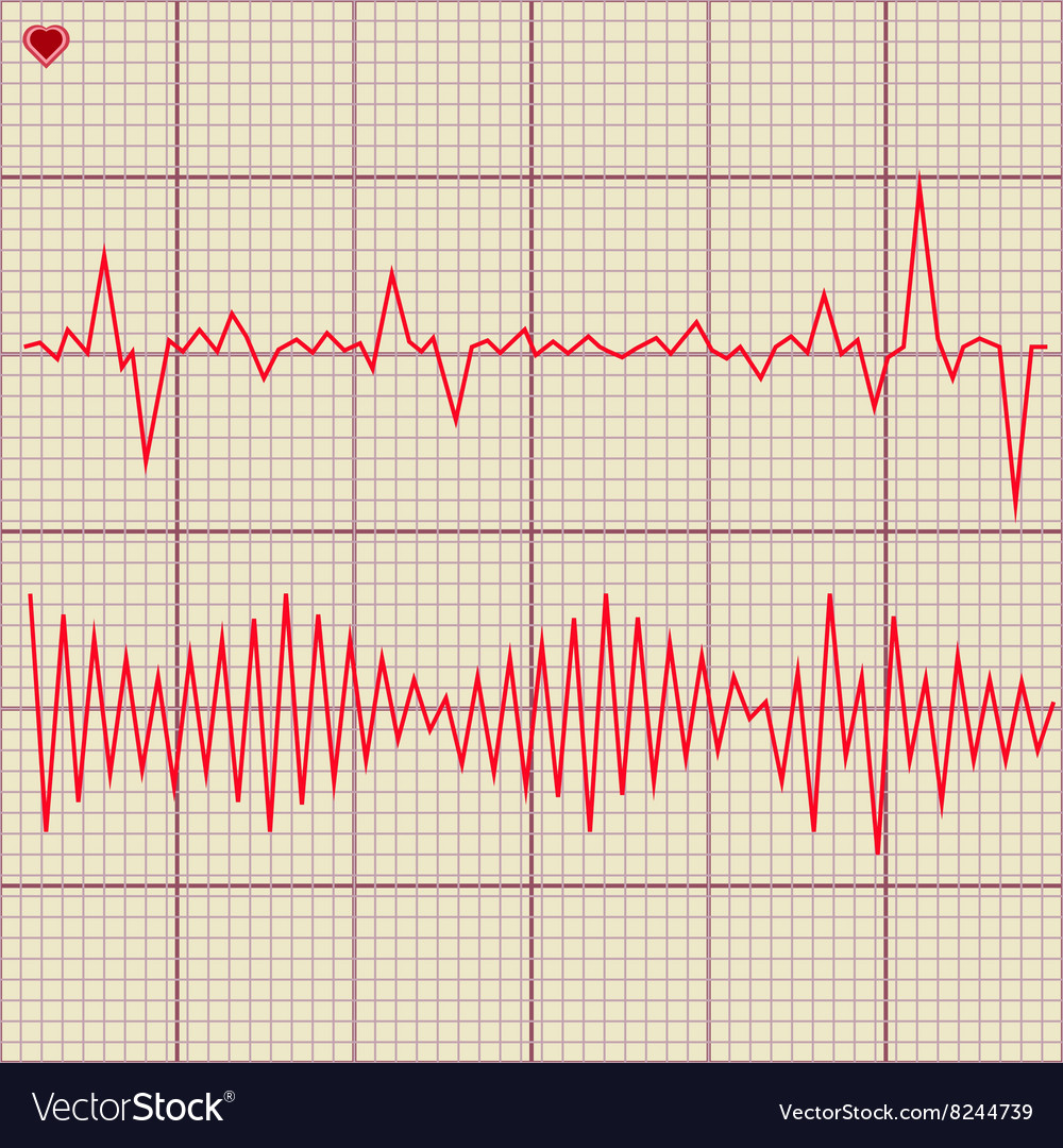 Set Of Various Cardiogram Design Elements Vector Image