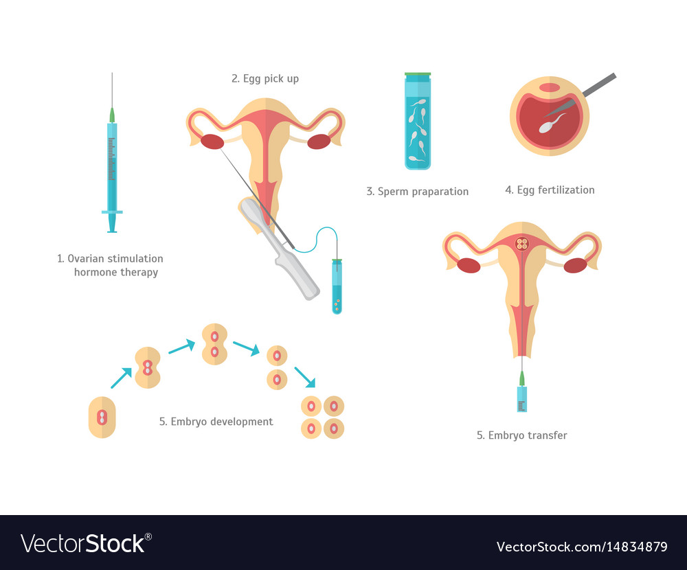 Concept in vitro fertilization Royalty Free Vector Image