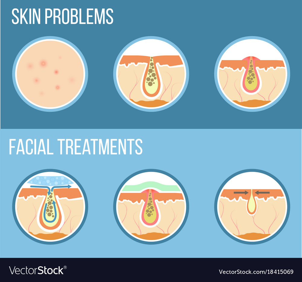 Mass tourism advantages and disadvantages. So such too enough правила. Such problems. Such problems. Ecological problems топик 9 класс.