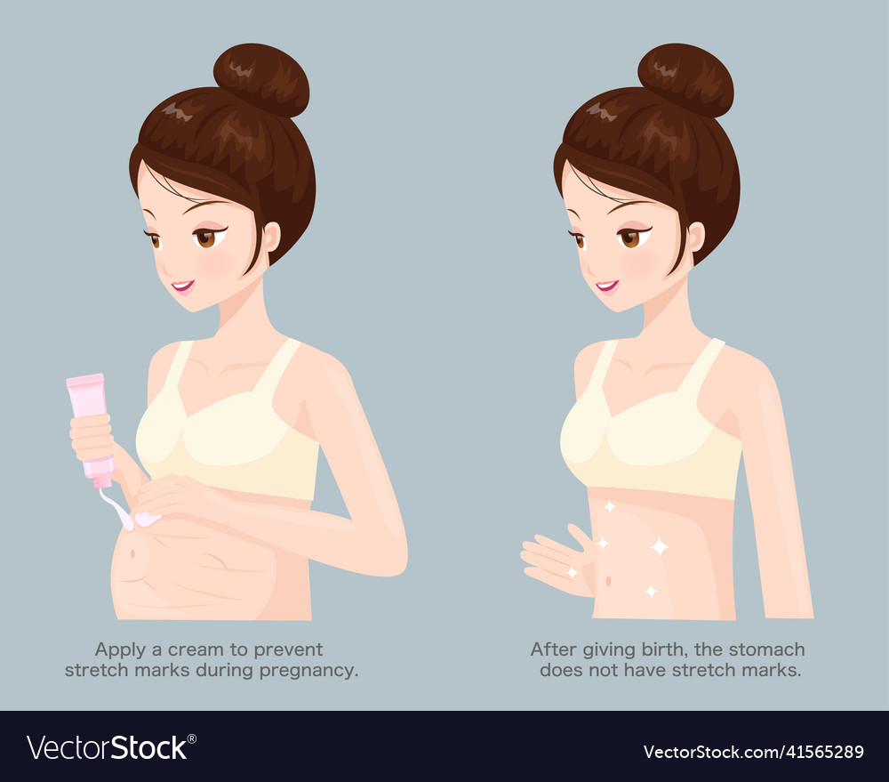 Eliminate stretch marks from pregnancy