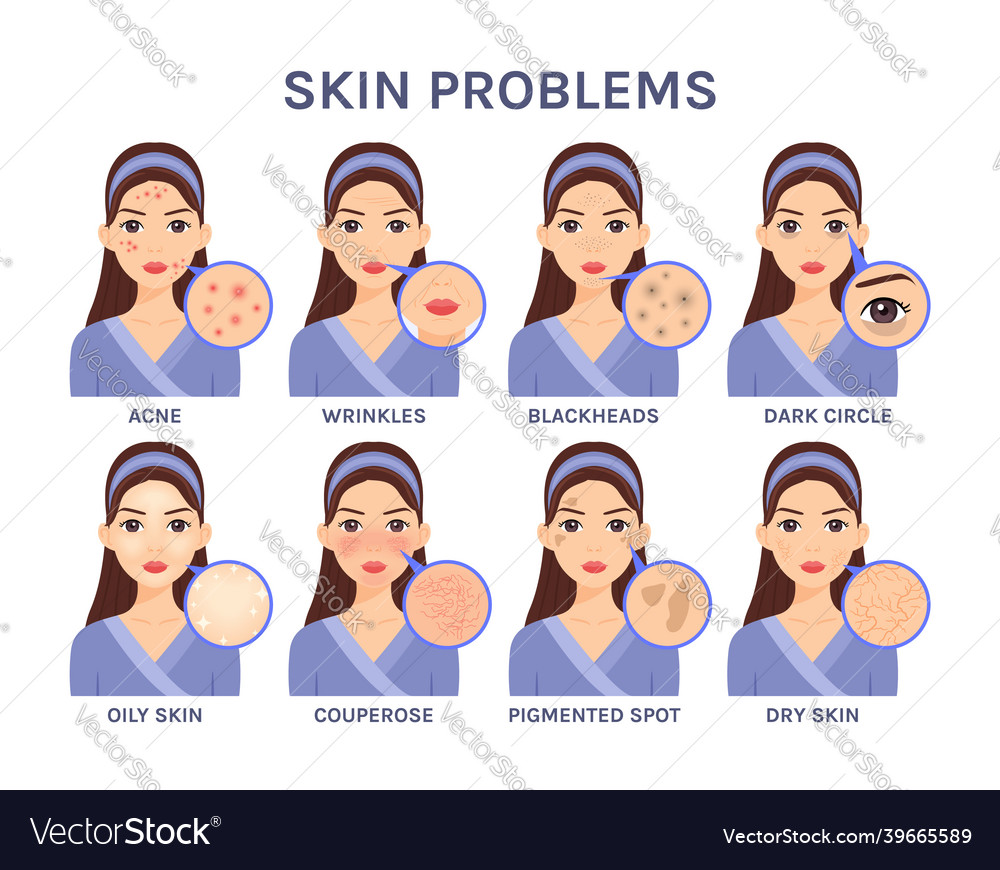 Beautiful cartoon woman and skin problemsportrait Vector Image Beautiful cartoon woman and skin problemsportrait Vector Image