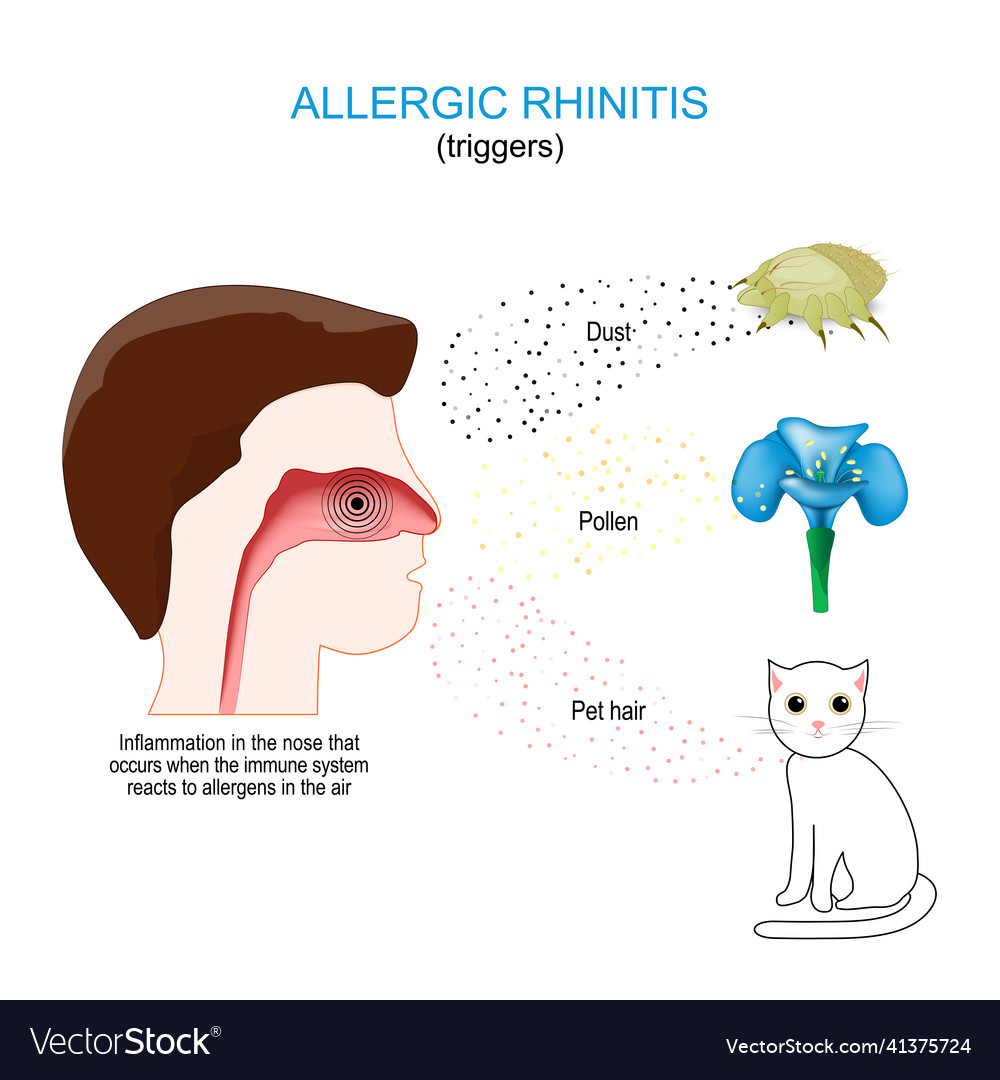 Allergic Rhinitis Triggers Royalty Free Vector Image