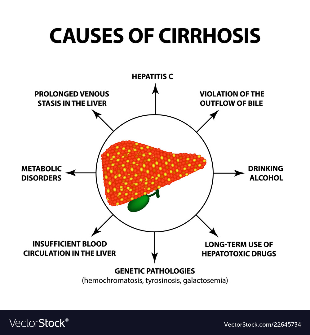 Causes Of Cirrhosis