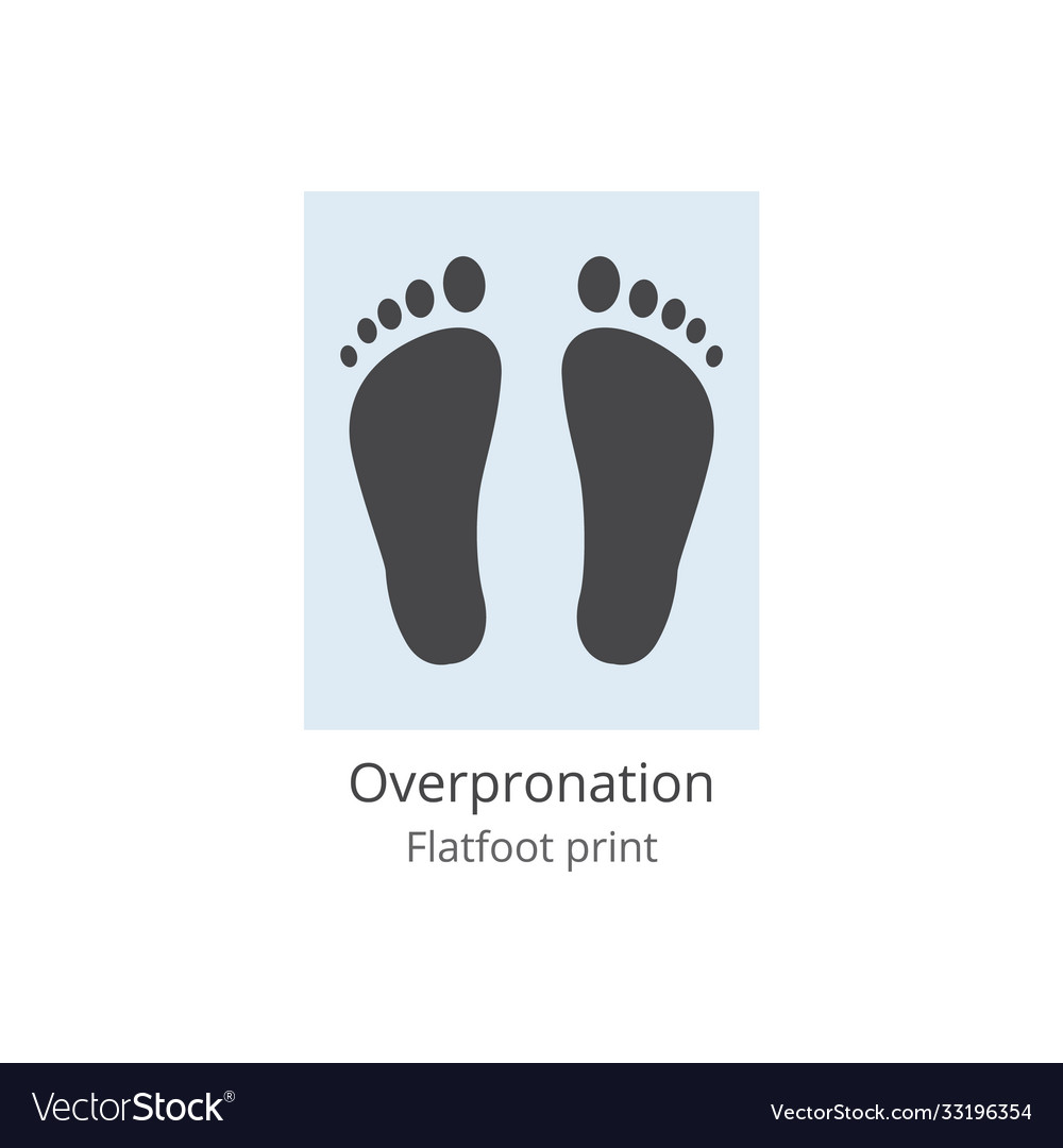 Overpronation flatfoot print unhealthy feet