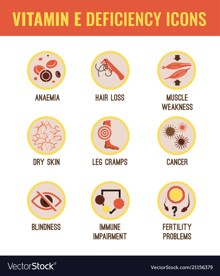 Vitamin E Deficiency Royalty Free Vector Image