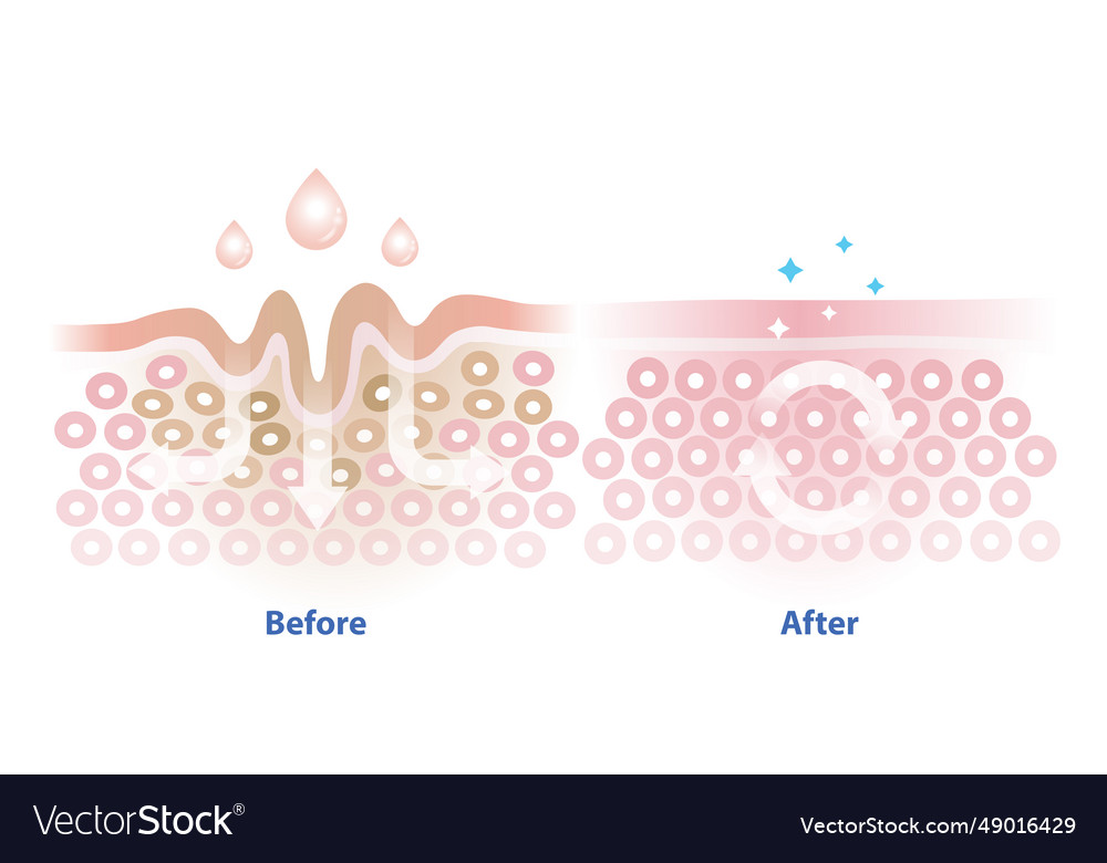 Before and after skincare absorption Royalty Free Vector