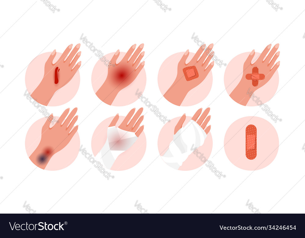 Human body parts a physical injury Royalty Free Vector Image