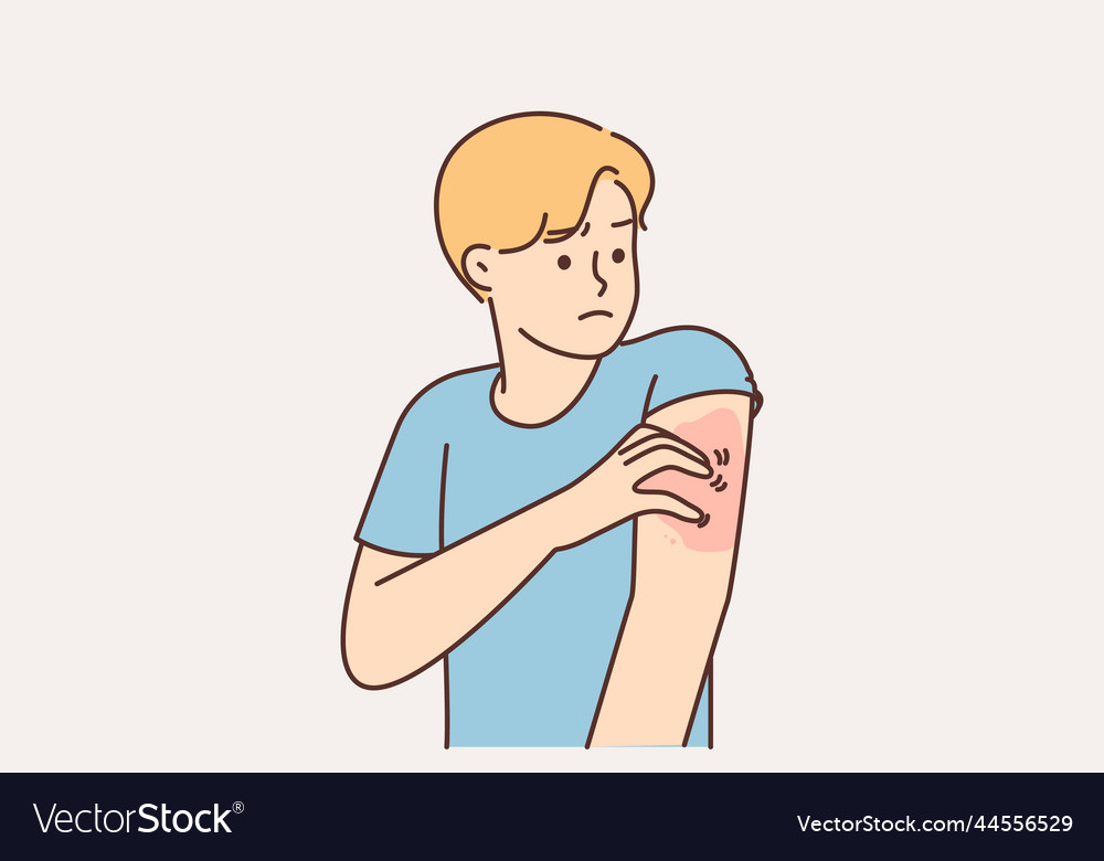 Unhealthy man scratching arm suffer from pox Vector Image