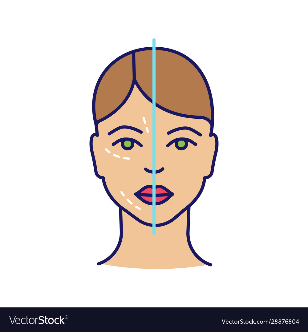 Before and after neurotoxin injection color icon vector image Before and after neurotoxin injection color icon