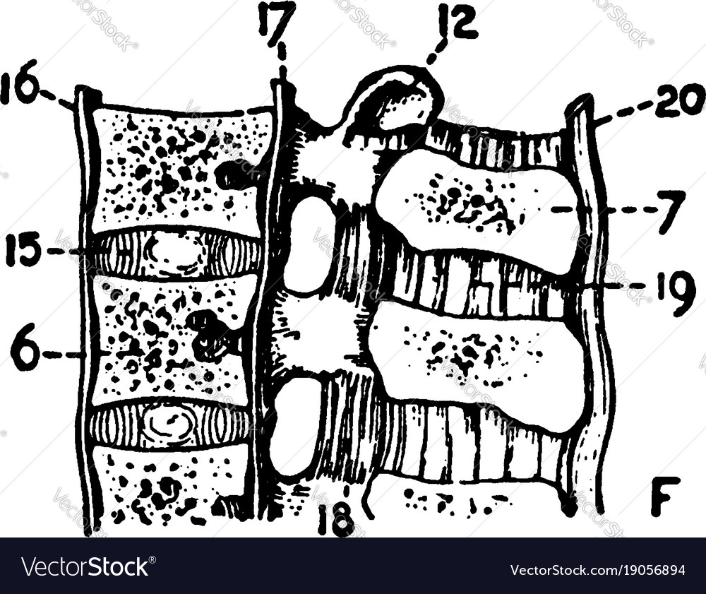 Lumbar vertebrae vintage