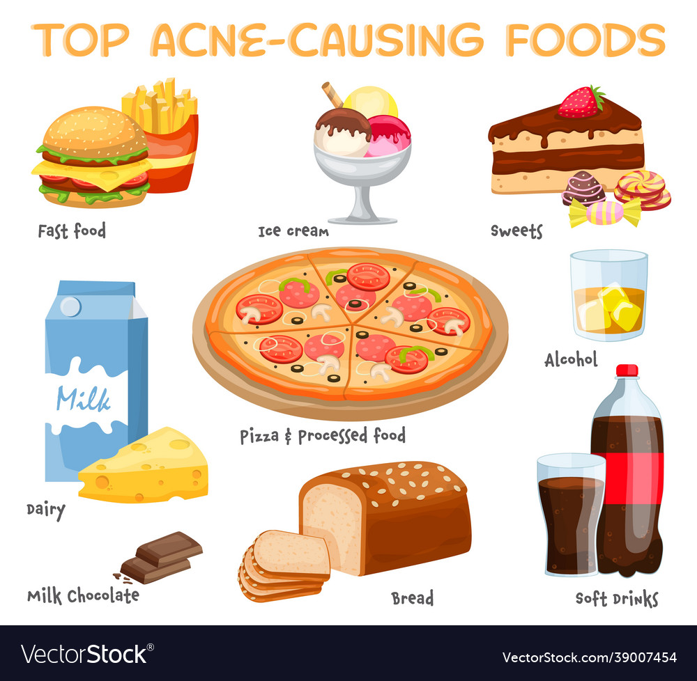 what-causes-acne-acne-causing-food-royalty-free-vector-image