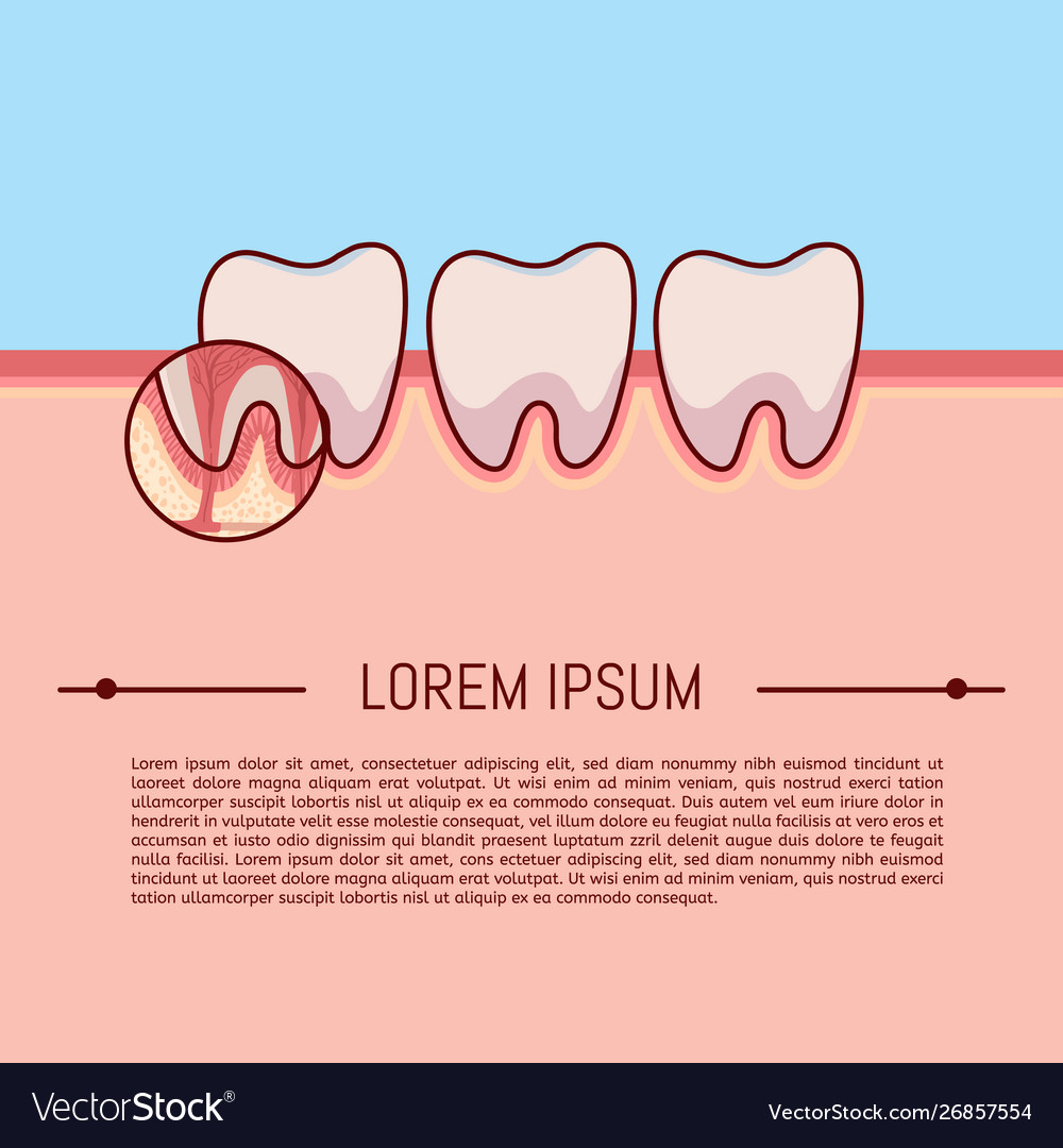 Layout cross-section structure inside tooth