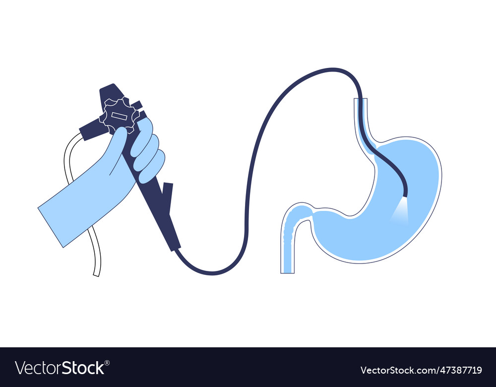 Gastroscopy endoscopy procedure