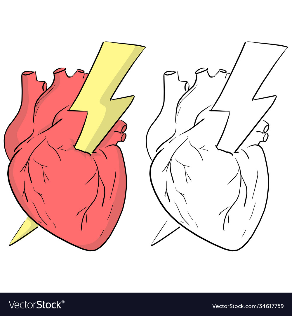 AED - Automated External Defibrillator