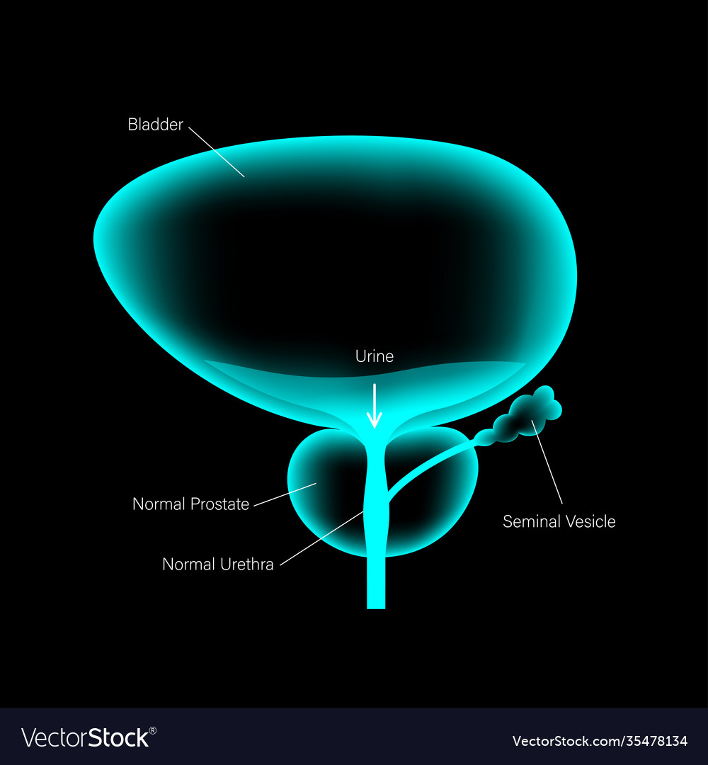 Bph info concept