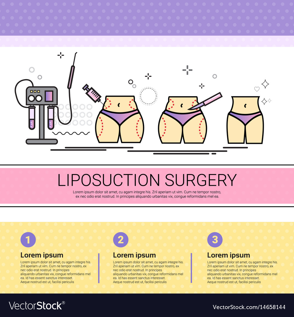 Liposuction surgery cosmetology infographics salon