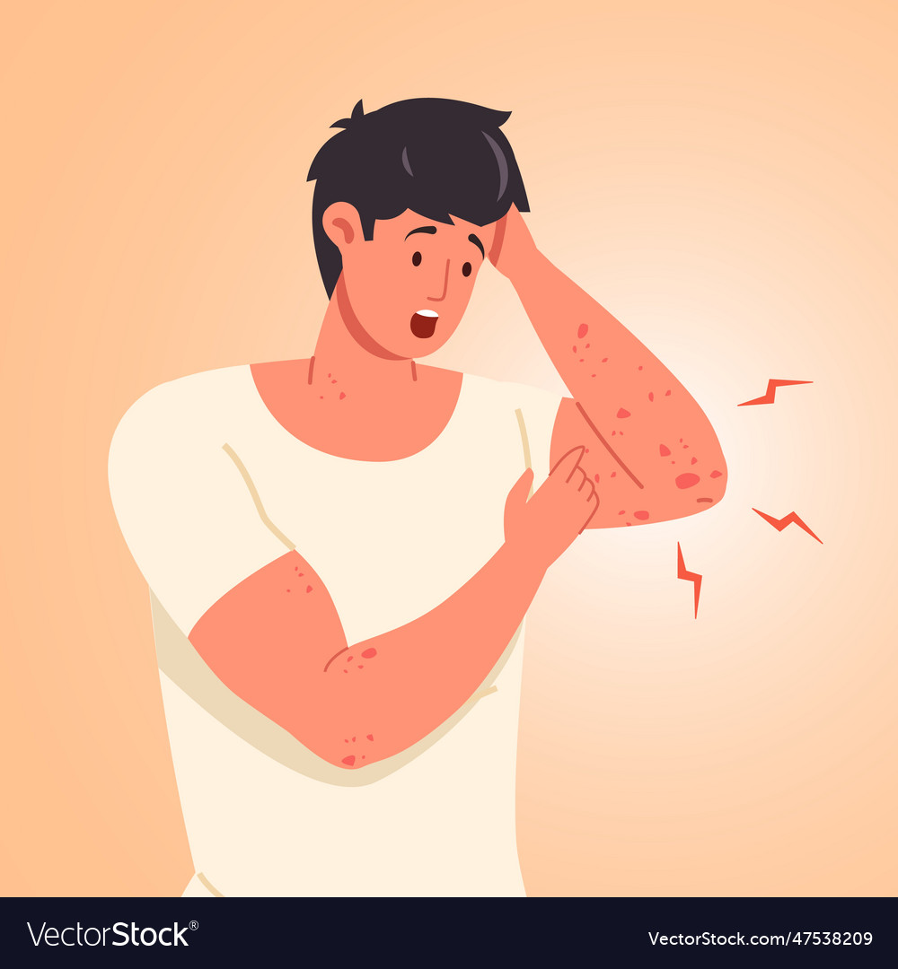 Man scratching skin guy scratch sensitive skins Vector Image