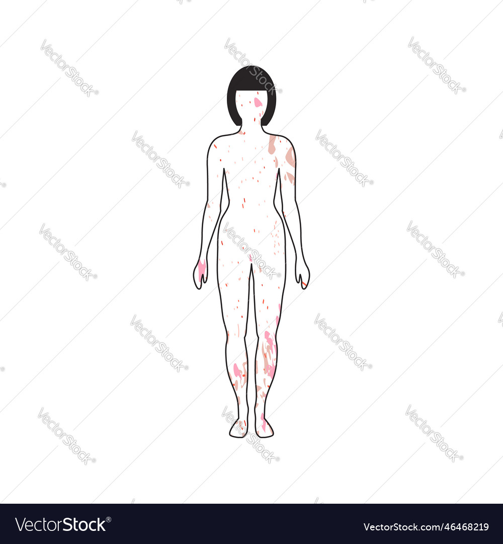 Frau mit Hautflecken