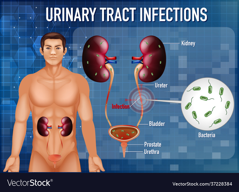 Information poster urinary tract infections