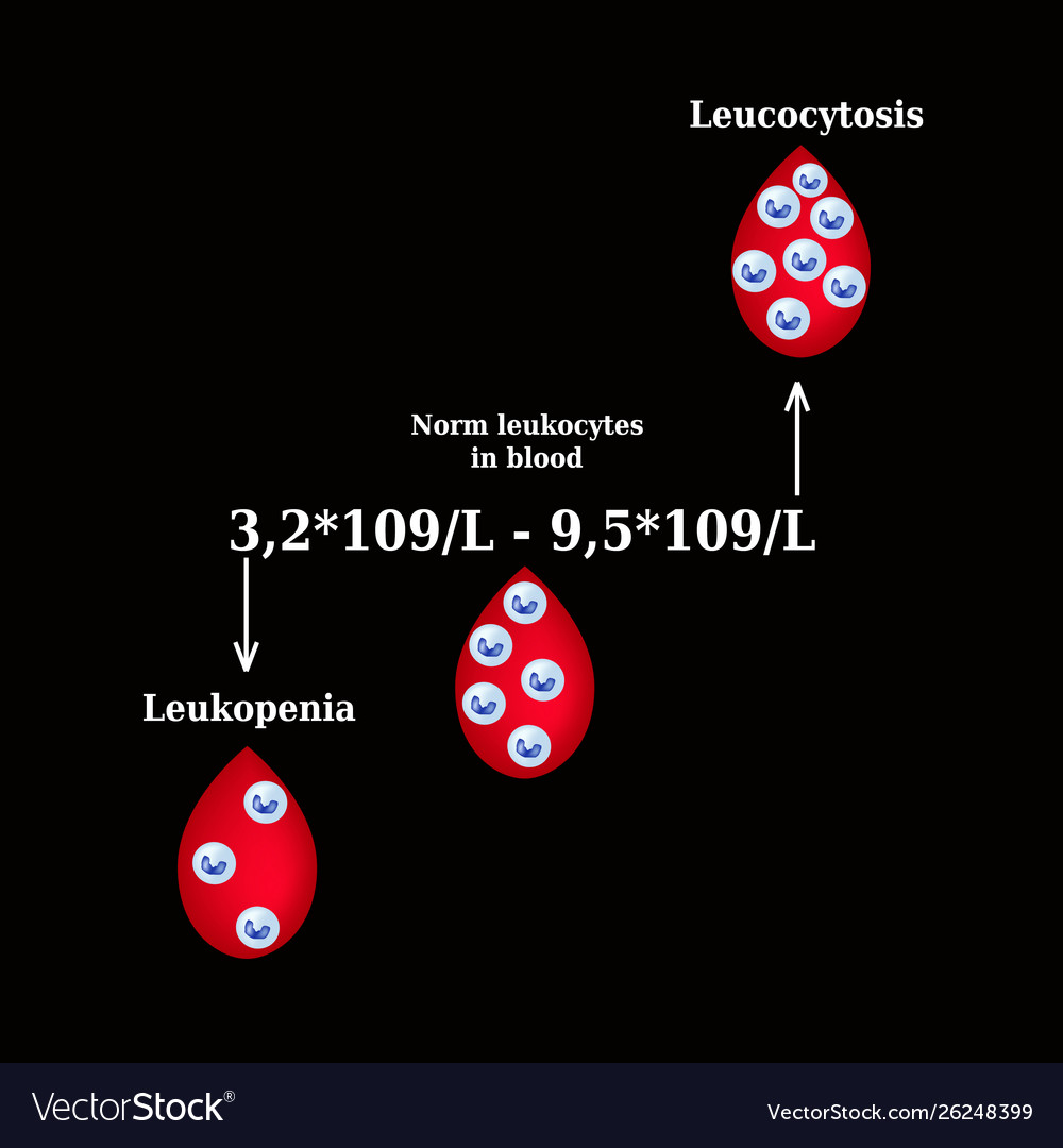 White blood cell count leukopenia leukocytosis Vector Image