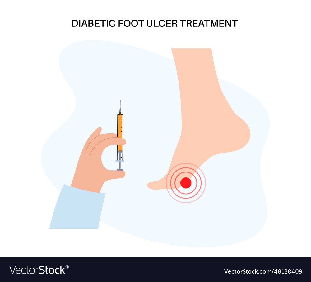 Diabetic foot ulcers