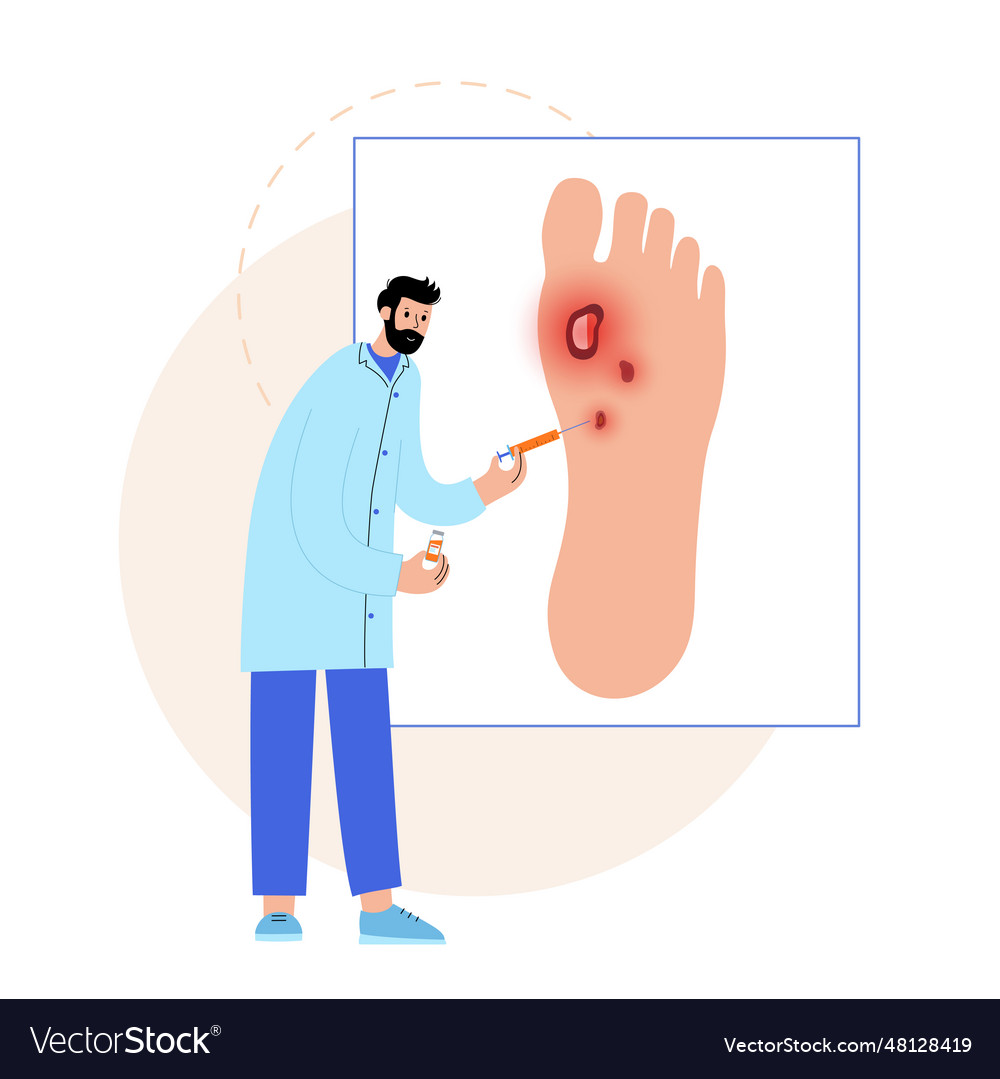 Diabetic foot ulcers Royalty Free Vector Image