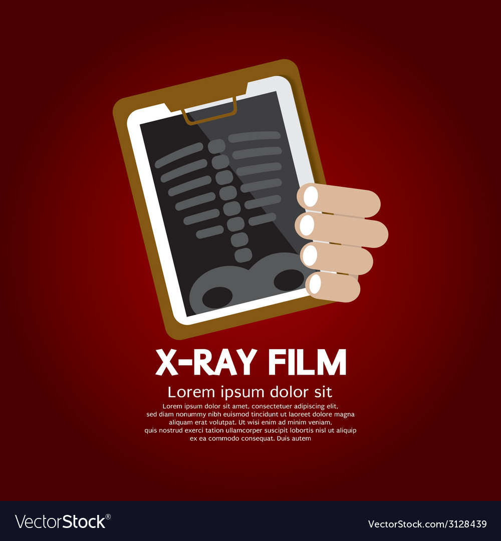 X-ray film